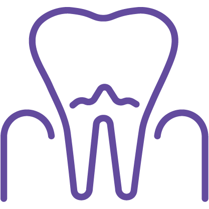 Dantų kanalų gydymas (endodontija)